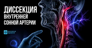 Статья 1
