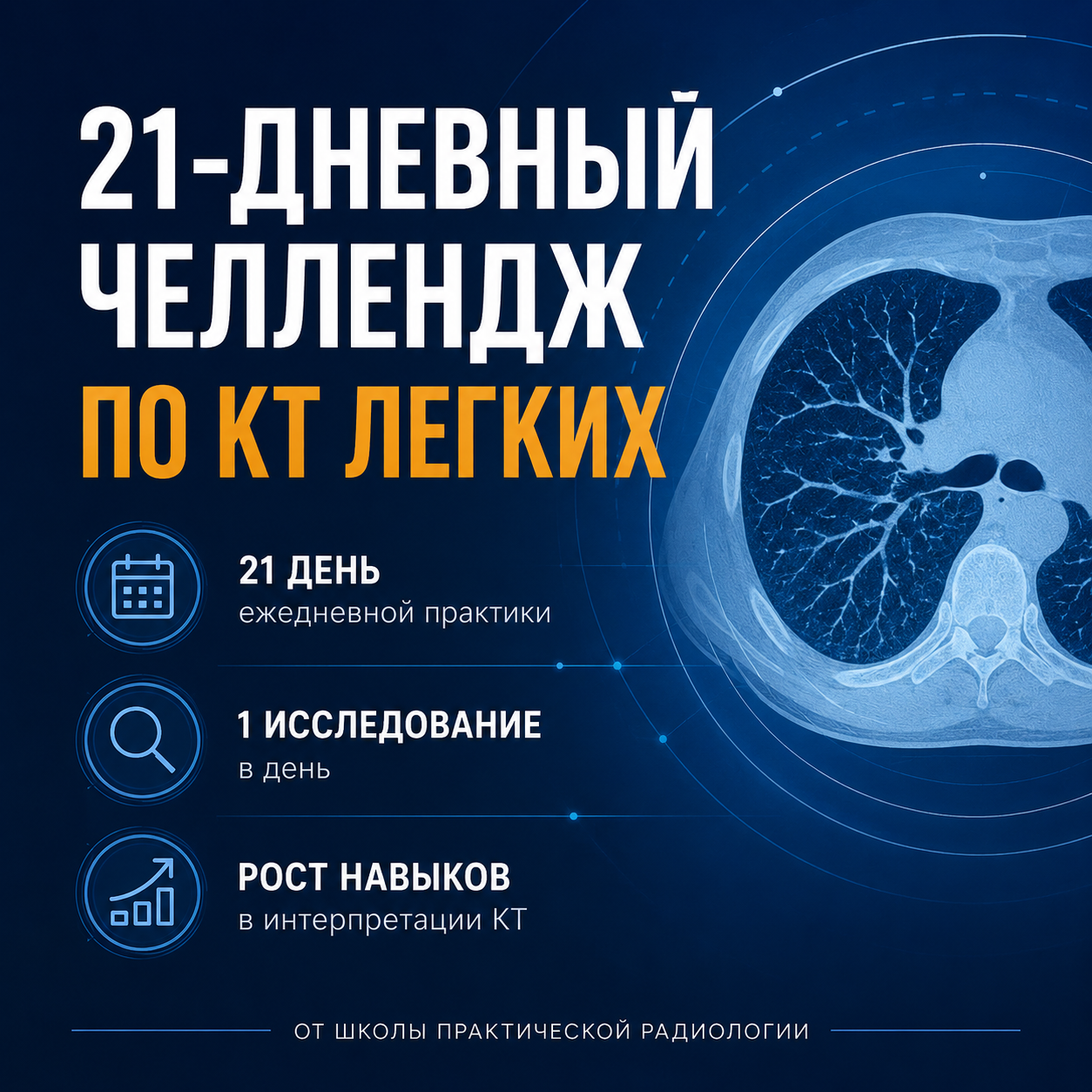 21 день — 21 исследование КТ-легких
